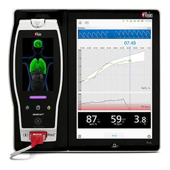 Masimo Root with O3