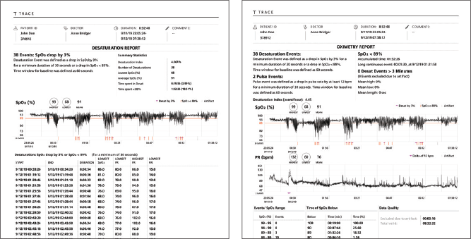 Masimo - Trace - % Times Report